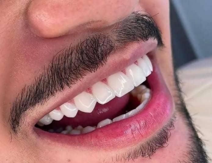 دندانسازی|خدمات آرایشگری و زیبایی|شیراز, زند|دیوار