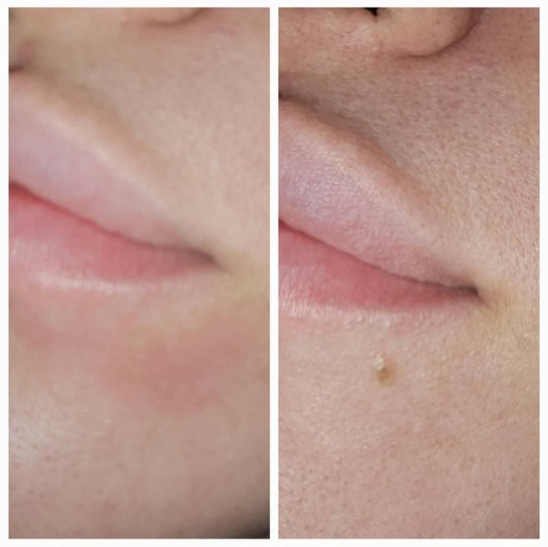 مرکز زیبایی دکتر تقوی|خدمات آرایشگری و زیبایی|یاسوج, |دیوار