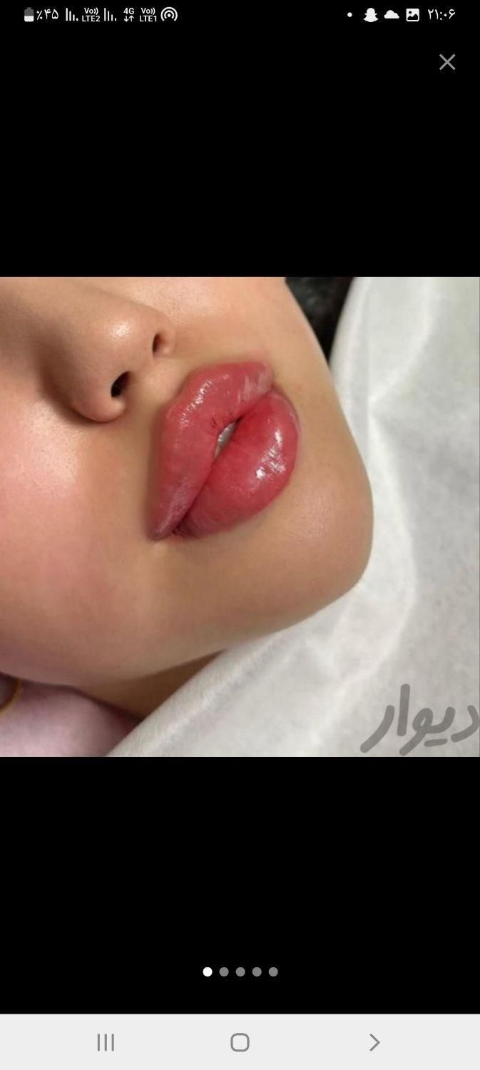 ژل فیلر بوتاکس مزو لیزر هایفو فیشیال خال مطب سلامت|خدمات آرایشگری و زیبایی|تبریز, |دیوار