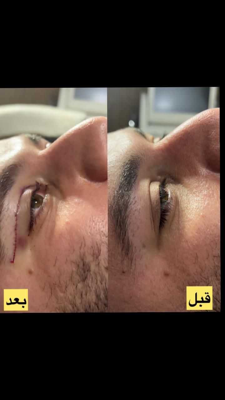 جشنواره بهاره  تزریق چربی جراحی پلک بلفارو بینی|خدمات آرایشگری و زیبایی|تهران, صادقیه|دیوار