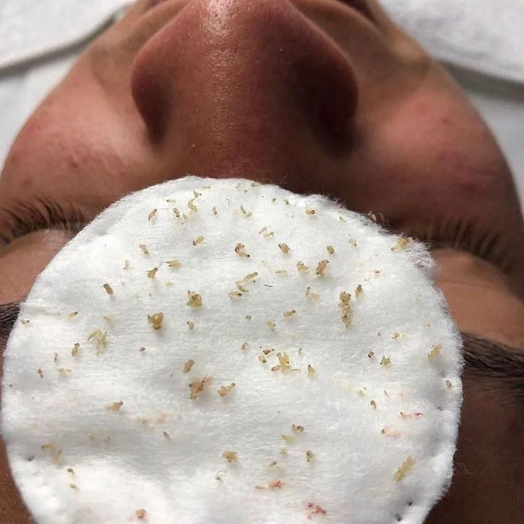 پاکسازی تخصصی پوست آقایان و بانوان|خدمات آرایشگری و زیبایی|گلستان (تهران), |دیوار