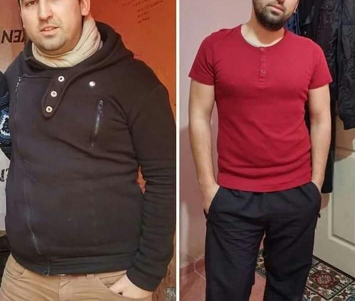 امبدینگ لاغری لیفت سینه وصورت با نخ|خدمات آرایشگری و زیبایی|قم, سالاریه|دیوار