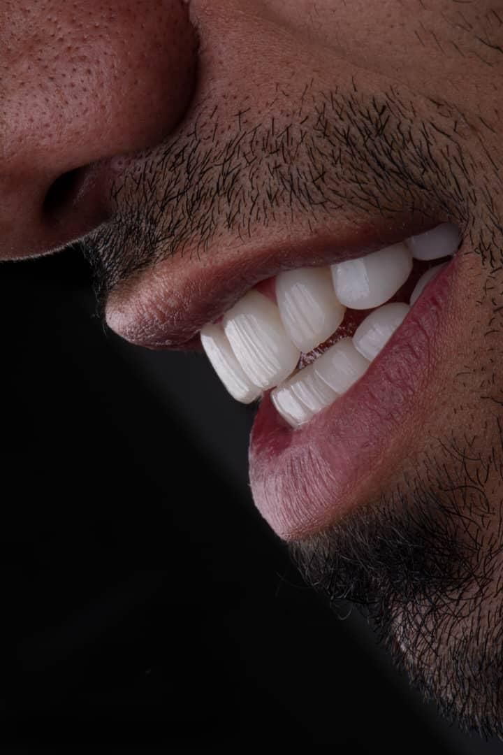 دندانپزشکی نقد و اقساط باتخفیفات بینظیر دندانپزشکی|خدمات آرایشگری و زیبایی|شیراز, قصرالدشت|دیوار