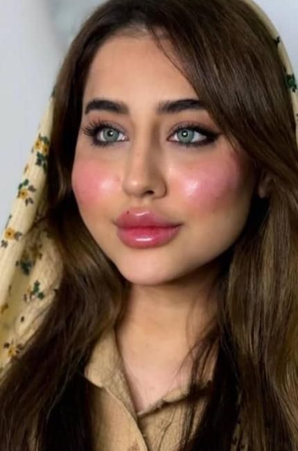 ژل بوتاکس آنزیم مطب پزشک|خدمات آرایشگری و زیبایی|کرج, عظیمیه|دیوار