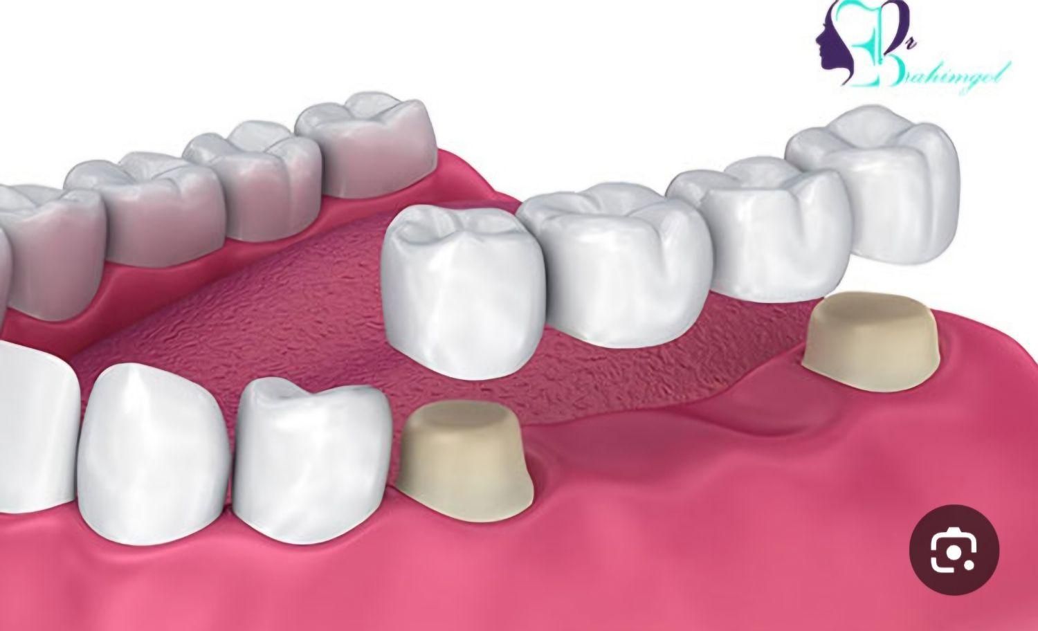 دنتال لند|خدمات آرایشگری و زیبایی|کرمانشاه, |دیوار