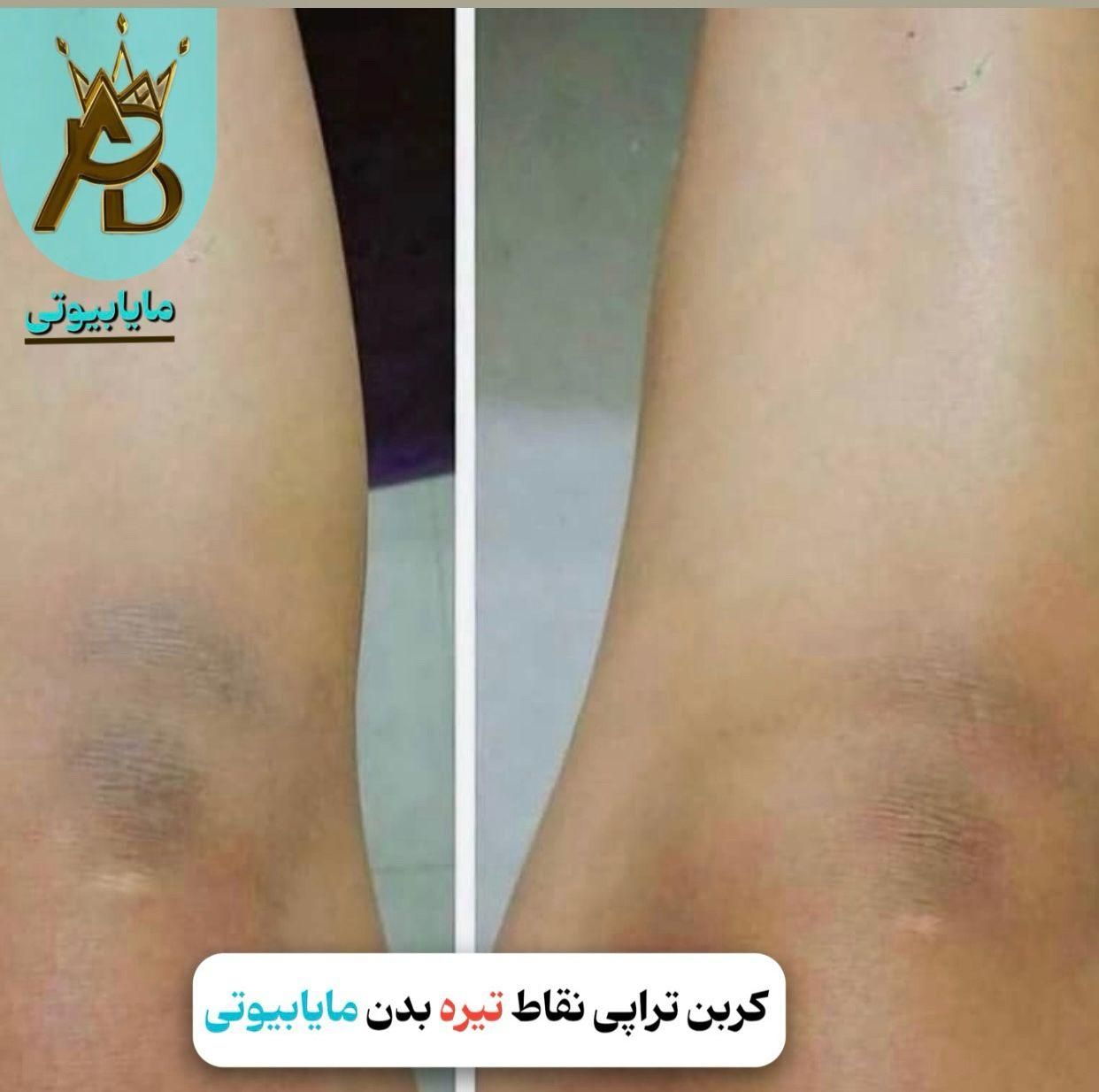 اولین مرکز روشن کننده بیکینی و زیربغل،مایابیوتی|خدمات آرایشگری و زیبایی|یاسوج, |دیوار