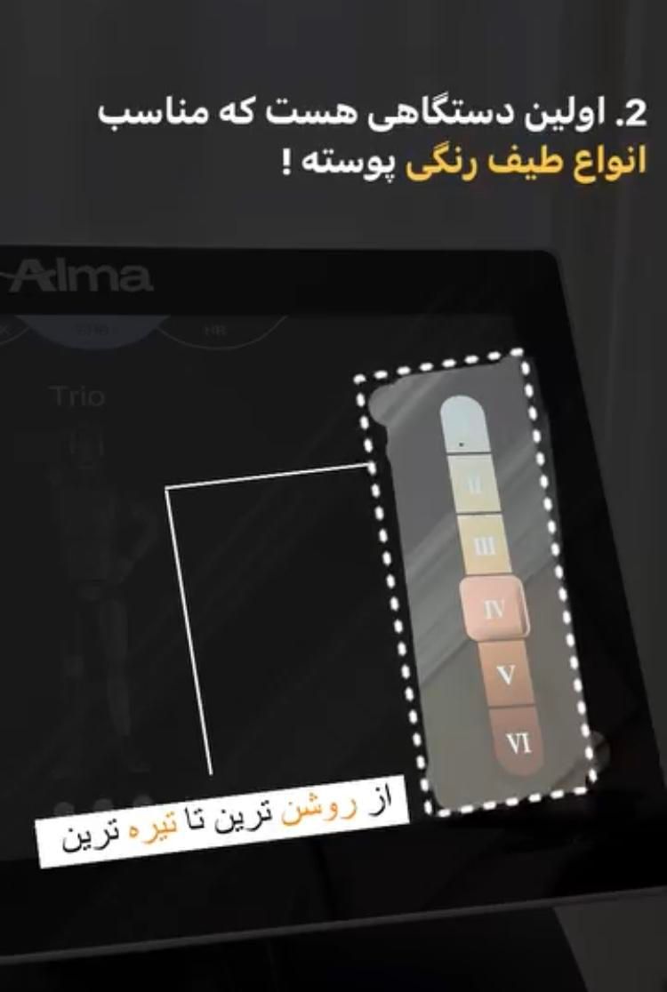 لیزر موهای زائدتضمینی 2025 بی درد ریموتتو هایفو|خدمات آرایشگری و زیبایی|تهران, صادقیه|دیوار