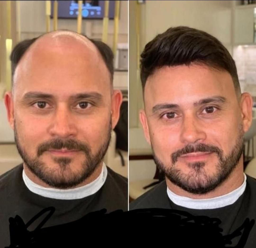 پروتز مو ، چسب پروتز ، ترمیم و تعویض چسب|خدمات آرایشگری و زیبایی|تبریز, |دیوار