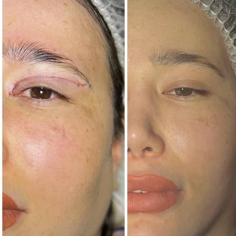 جراحی عمل پلک/بلفاروپلاستی/ساکشن غبغب/سانترال لب|خدمات آرایشگری و زیبایی|کرج, عظیمیه|دیوار