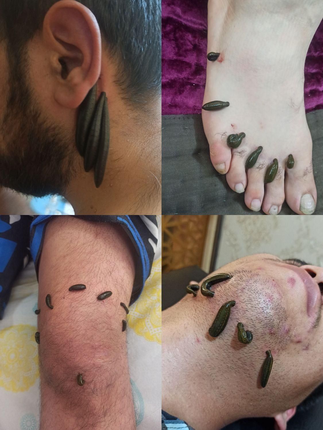دیسک کمر سیاتیک فیزیوتراپی بادکش زالو درمانی حجامت|خدمات آرایشگری و زیبایی|تهران, سبلان (لشگر)|دیوار
