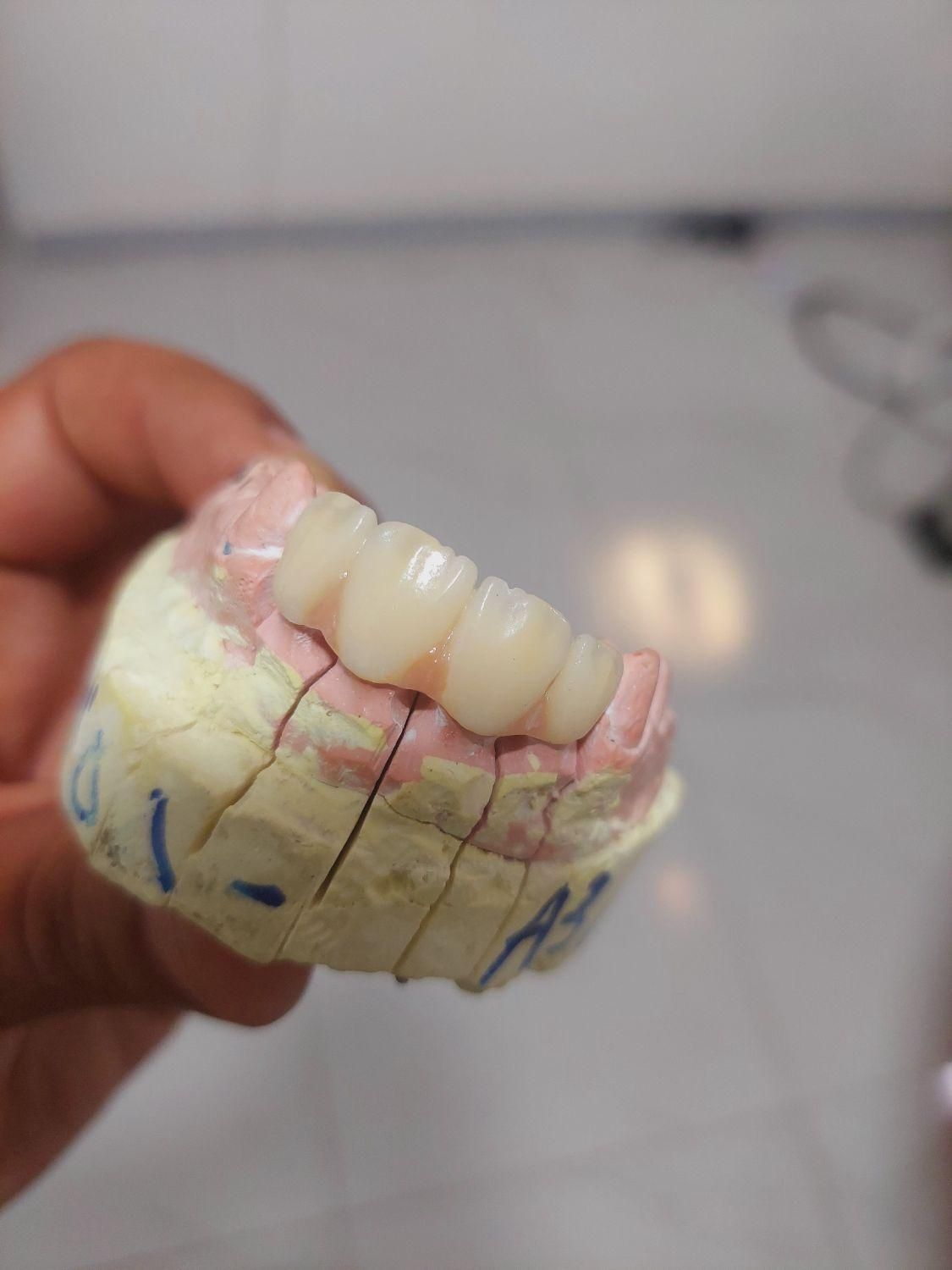 دنتال لند|خدمات آرایشگری و زیبایی|کرمانشاه, |دیوار