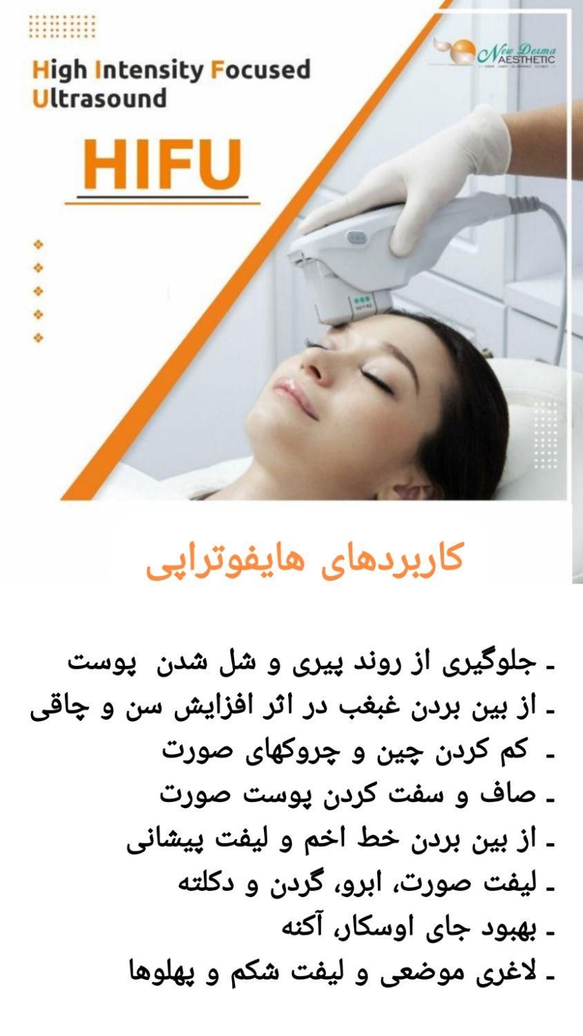 کیوسوئیچ، ریموو تتو،هایفو، جوانسازی،لیزر|خدمات آرایشگری و زیبایی|آبادان, |دیوار
