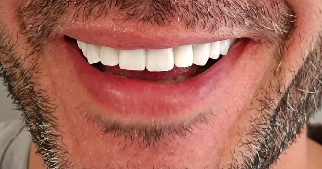 دندانپزشکی نقدواقساط باتخفیفات بینظیر فقط بمدت۷روز|خدمات آرایشگری و زیبایی|شیراز, ملاصدرا|دیوار