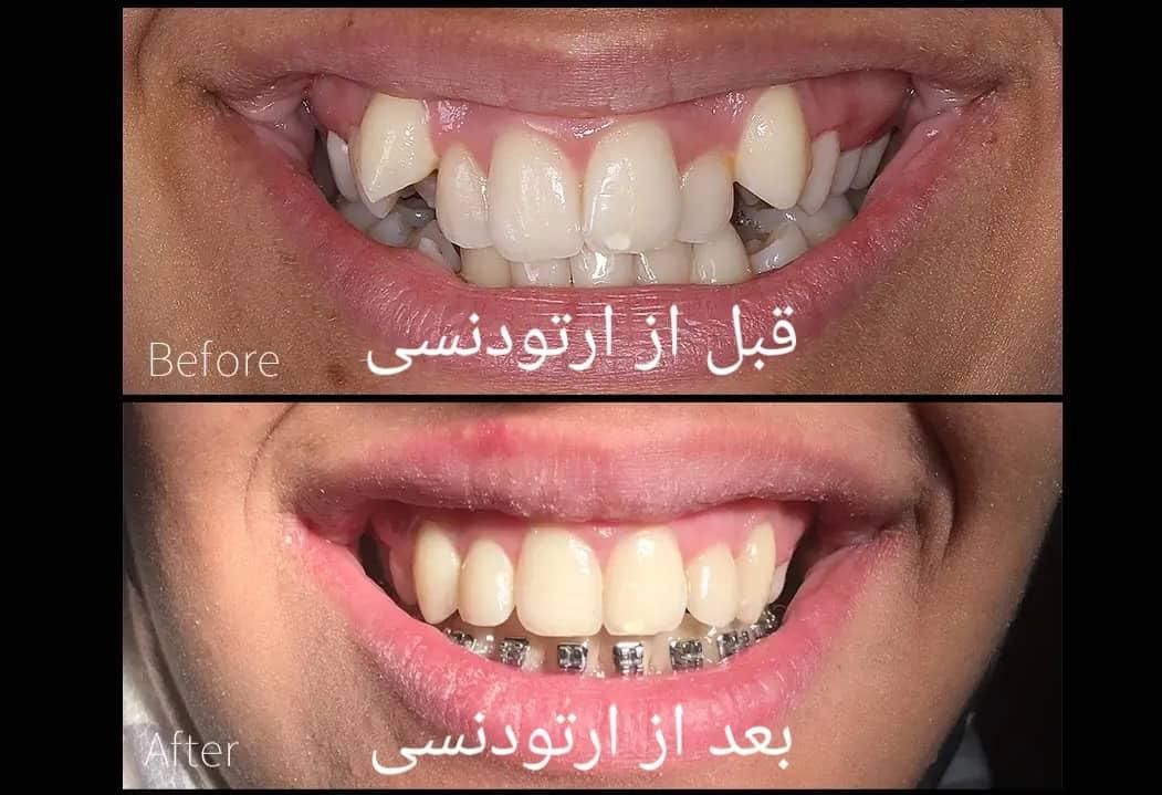 کامپوزیت،ارتودنسی،ایمپلنت|خدمات آرایشگری و زیبایی|بردسکن, |دیوار