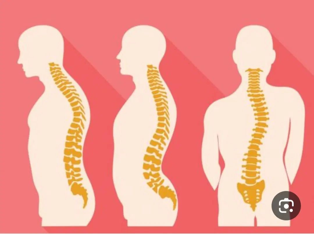 مرکز ارتوپدی درمان غیرجراحی انحراف ستون فقرات|خدمات آرایشگری و زیبایی|ملایر, |دیوار