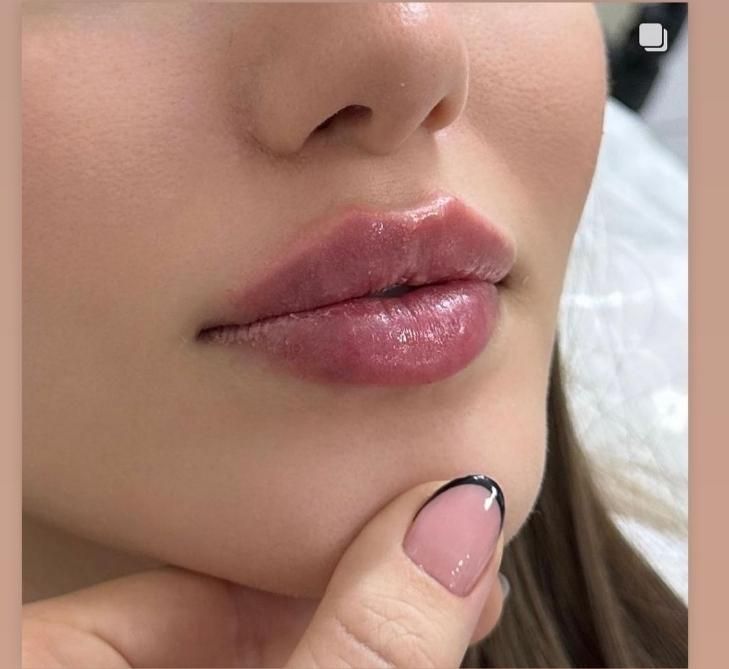 ژل /بوتاکس فیلر لب روسی اموزش بوتاکس آنزیم چربی|خدمات آموزشی|خرم‌آباد, |دیوار