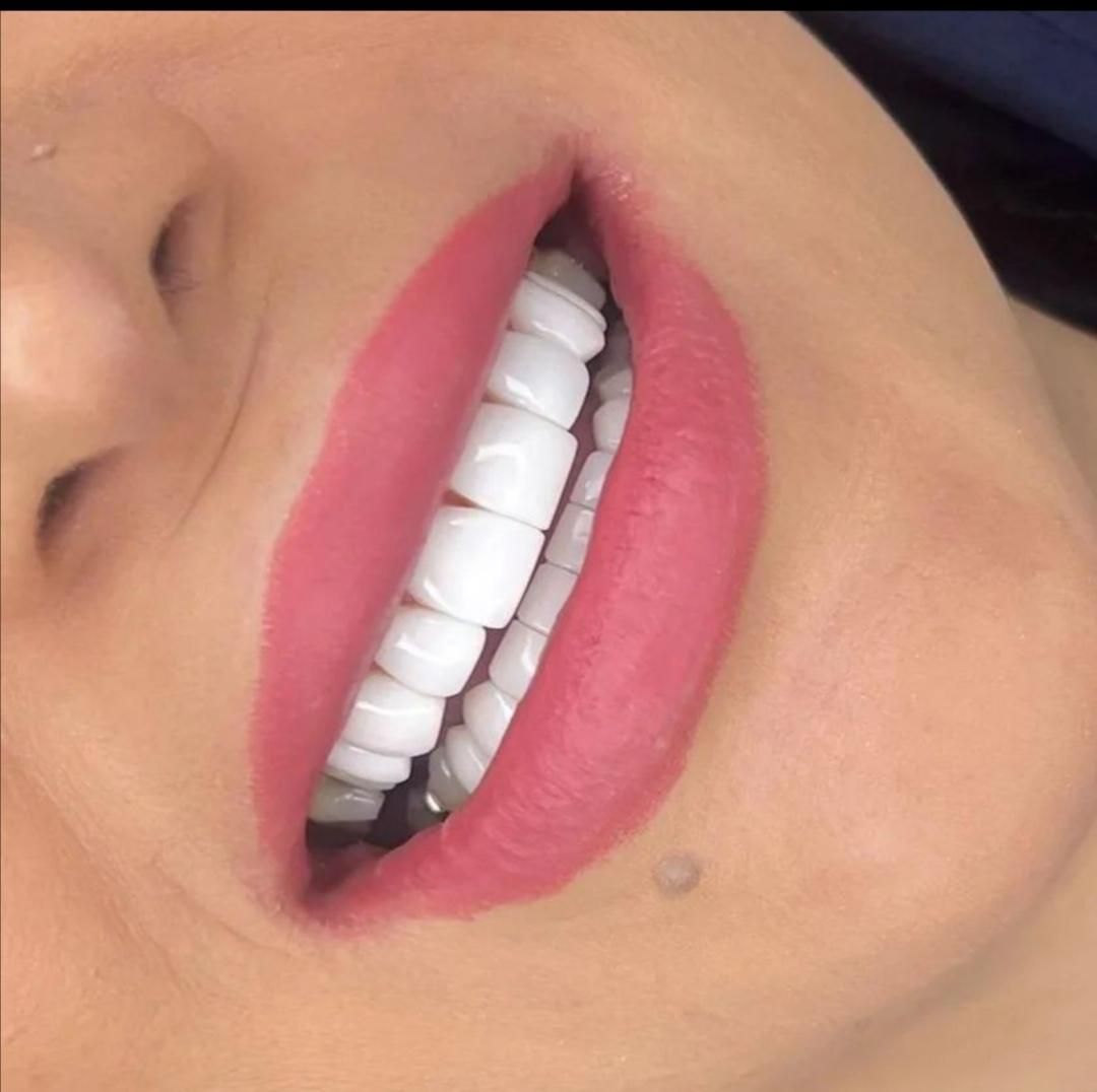 خدمات دندانپزشکی کامپوزیت دندان|خدمات آرایشگری و زیبایی|اسلام‌شهر, باغ فیض|دیوار