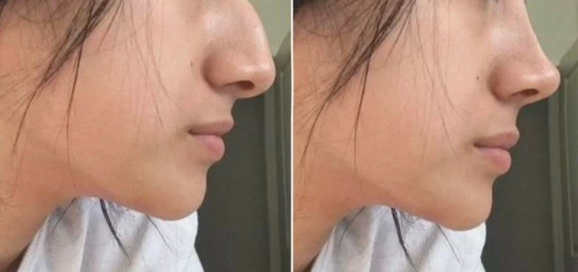 جراحی و‌ عمل  زیبایی صورت و‌بدن|خدمات آرایشگری و زیبایی|تهران, سهروردی|دیوار