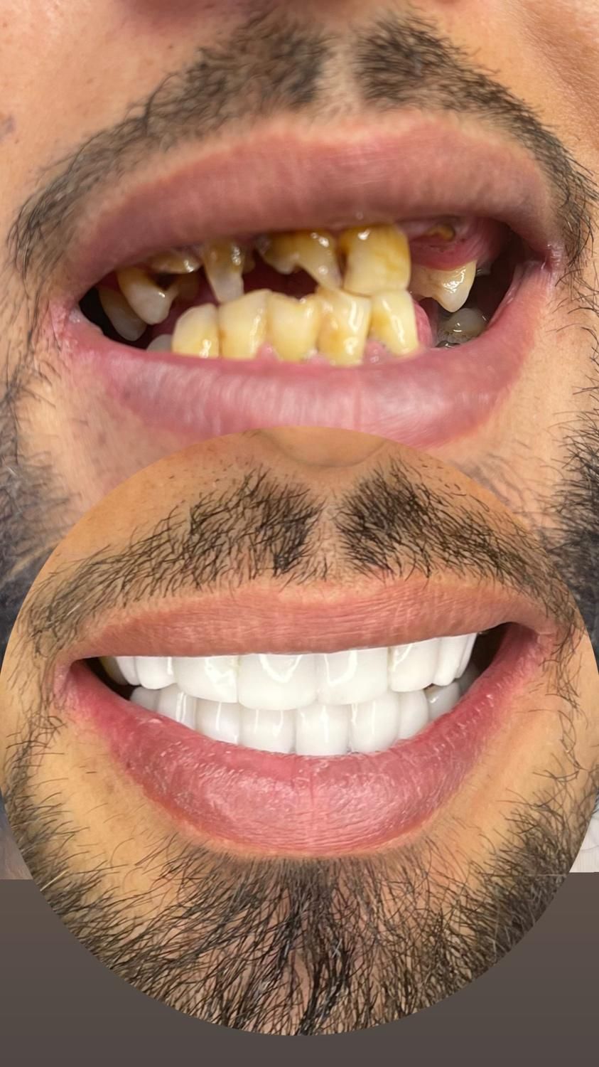 کامپوزیت دندان|خدمات آرایشگری و زیبایی|سبزوار, کاشفی شمالی (دادگستری)|دیوار