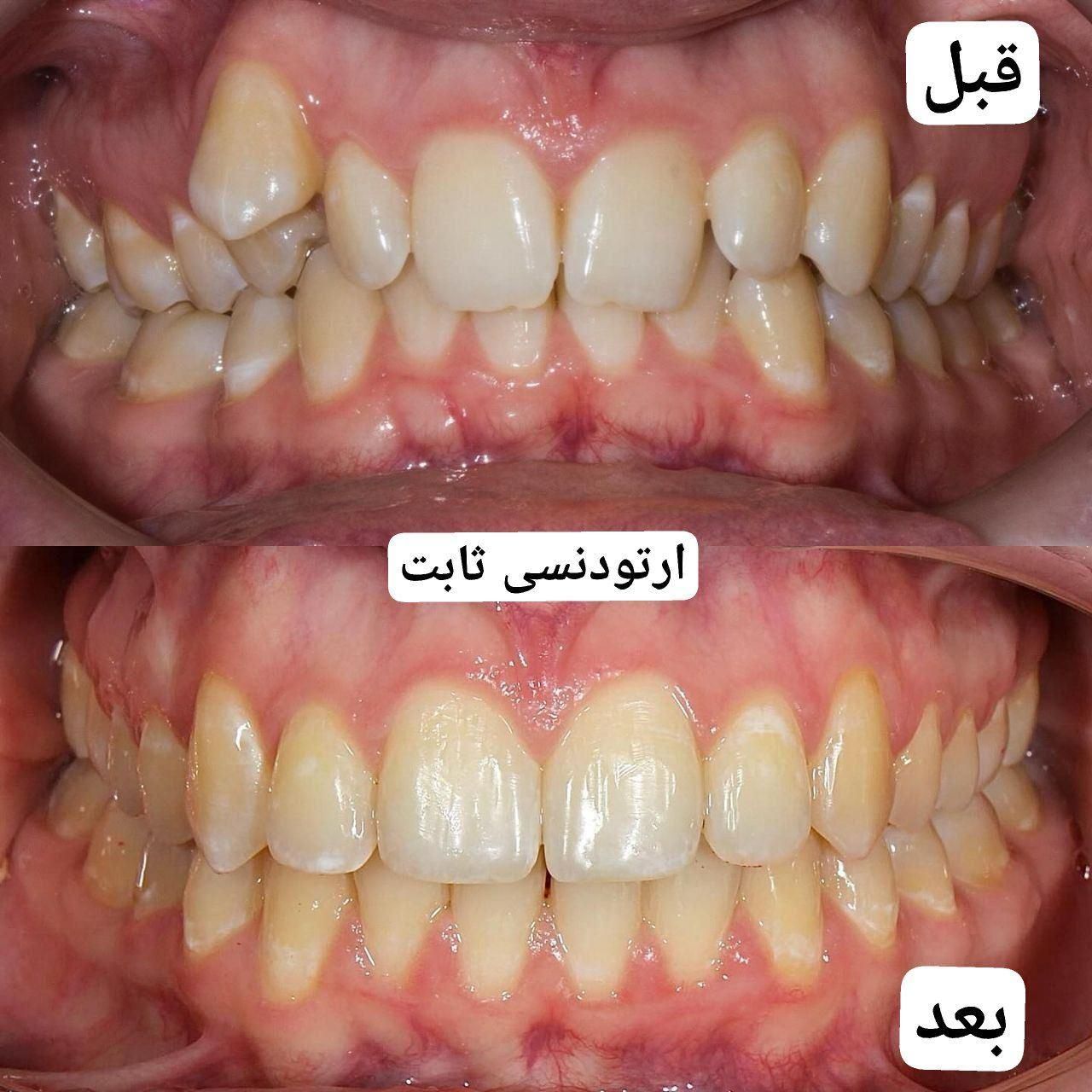 دندانپزشکی ایمپلنت کامپوزیت ارتودنسی لمینت روکش|خدمات آرایشگری و زیبایی|تبریز, |دیوار
