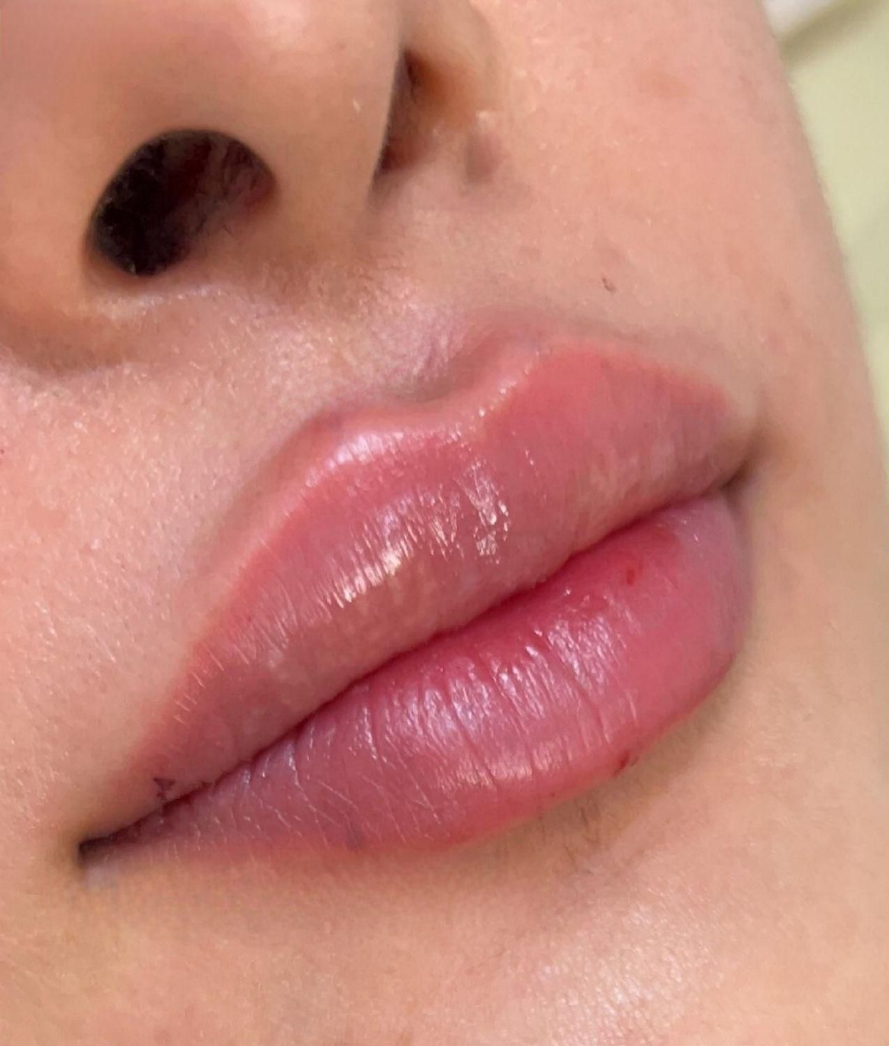 لیزر مو جشنواره. ژل بوتاکس حذف تتو و لک جوانسازی|خدمات آرایشگری و زیبایی|ساری, |دیوار