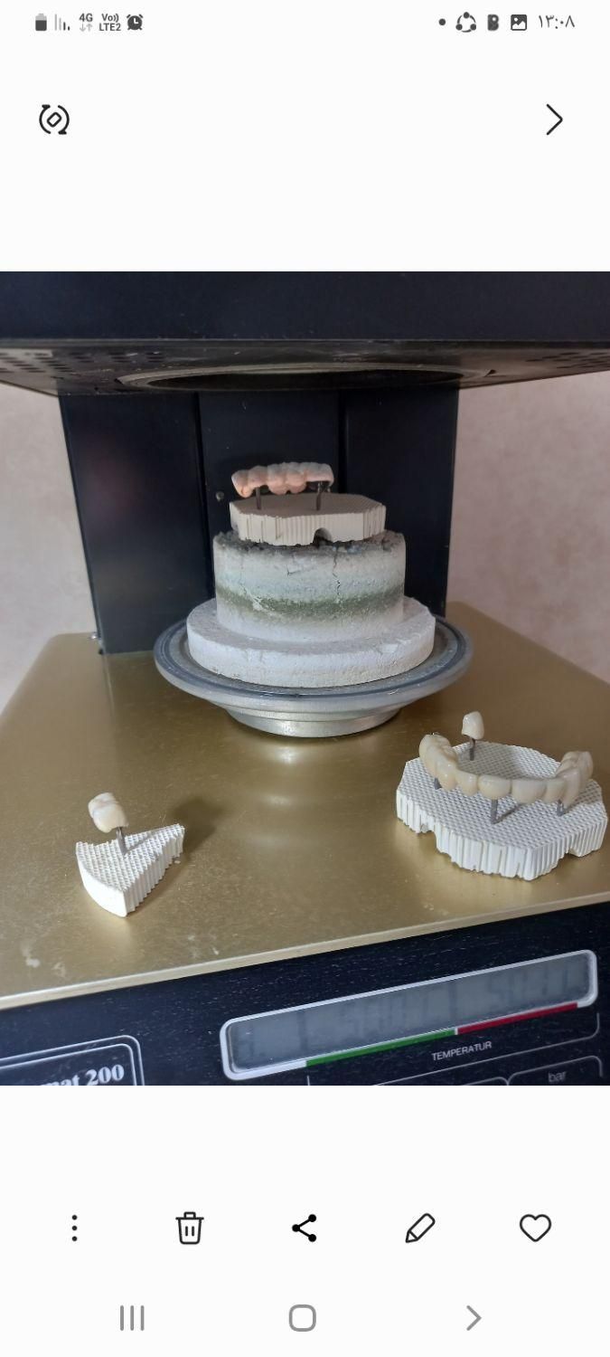 دندانسازی ساخت دندان مصنوعی|خدمات آرایشگری و زیبایی|تهران, اکباتان|دیوار