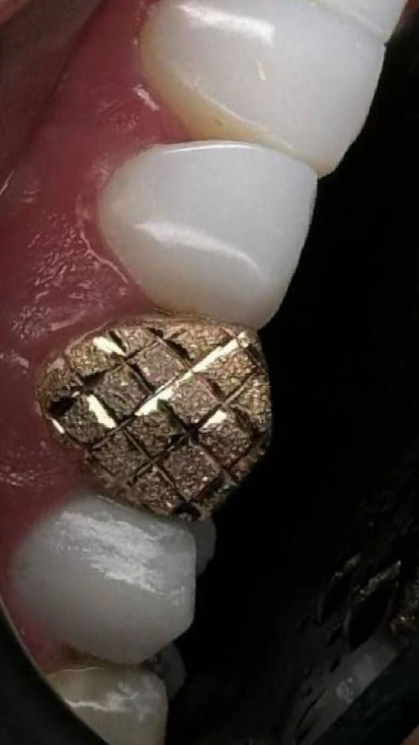 دندان مصنوعی|خدمات آرایشگری و زیبایی|اندیشه, اندیشه فاز ۱|دیوار