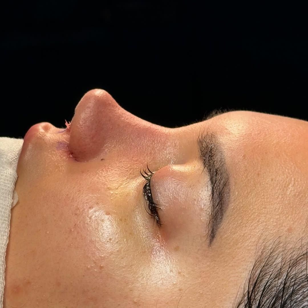 عمل بینی/پیکرتراشی /فقط با 20 /اقساطی ماهی پنج|خدمات آرایشگری و زیبایی|شیراز, زرگری|دیوار