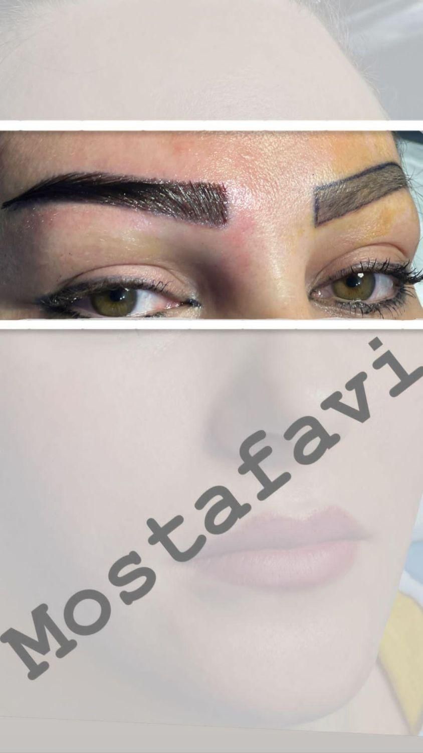 کاشت مو و ابرو با بروز ترین متد کاشت (تبریز)|خدمات آرایشگری و زیبایی|زنجان, |دیوار