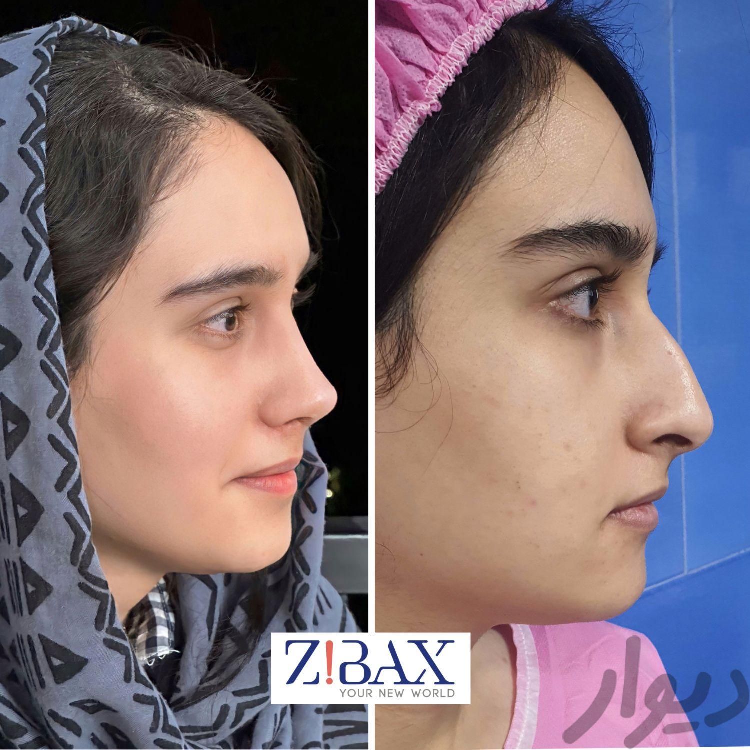 جراح عمل بینی در شیراز|خدمات آرایشگری و زیبایی|شیراز, فرهنگ شهر|دیوار