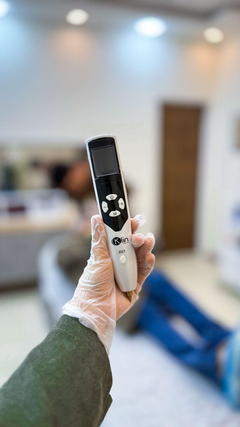 خالبرداری بدون جراحی در کلینیک زیبایی و لیزر راویس|خدمات آرایشگری و زیبایی|کاشان, رجایی|دیوار