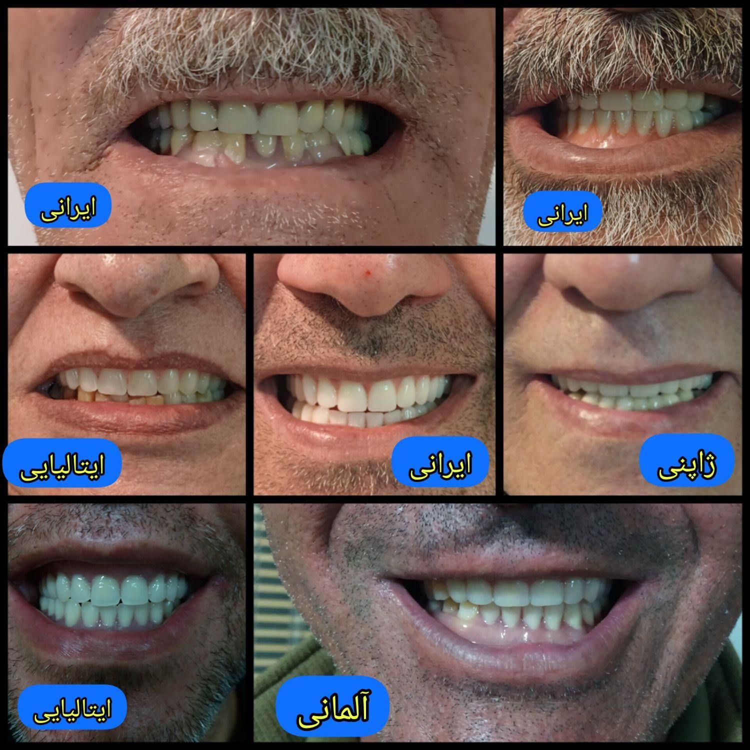 دندانسازی دندان مصنوعی|خدمات آرایشگری و زیبایی|شیراز, شهرک گلستان|دیوار