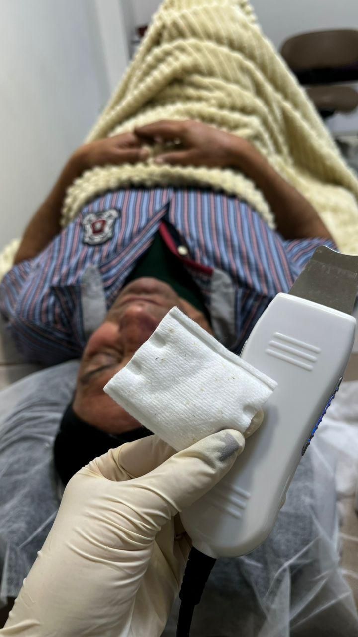 پاکسازی لیزرخالبرداری،توسط پزشک|خدمات آرایشگری و زیبایی|کارون, |دیوار