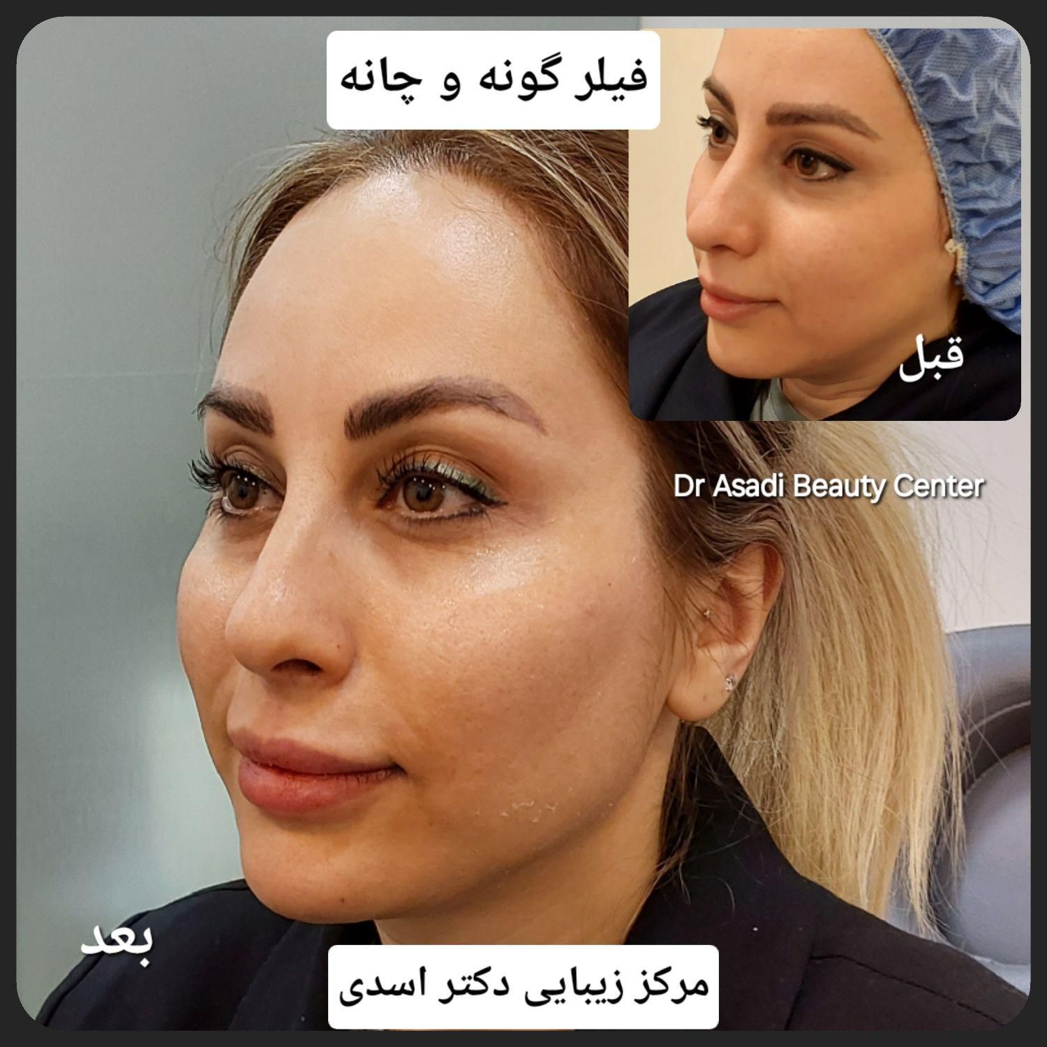 مرکز زیبایی دکتر اسدی (بوتاکس فیلر هایفو مزوتراپی)|خدمات آرایشگری و زیبایی|تهران, نیاوران|دیوار