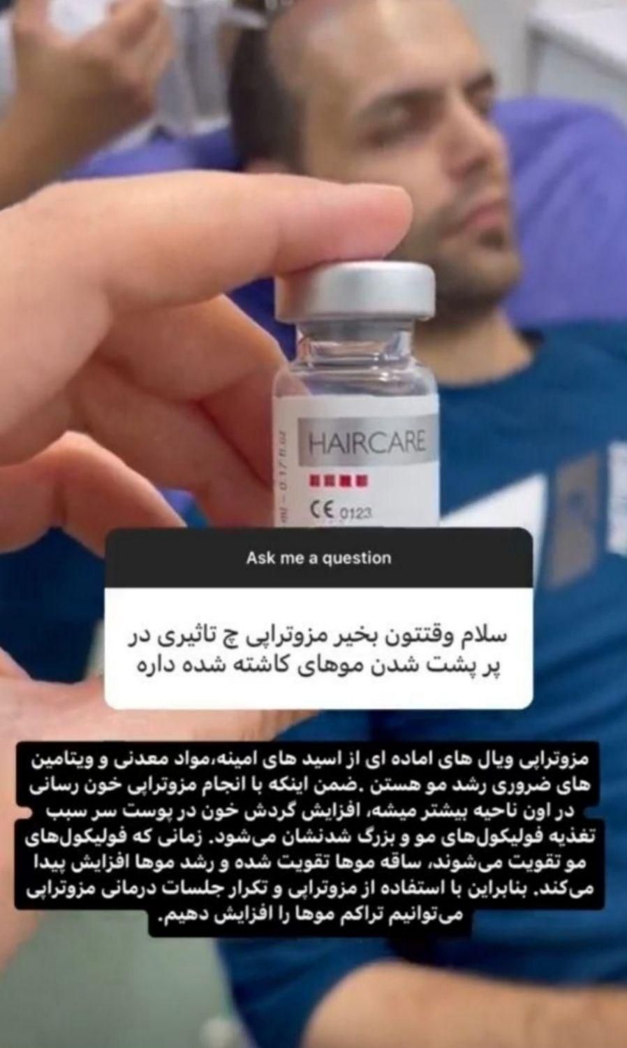 مزو تراپی و پی ار پی|آرایشی، بهداشتی، درمانی|مشهد, چهنو|دیوار