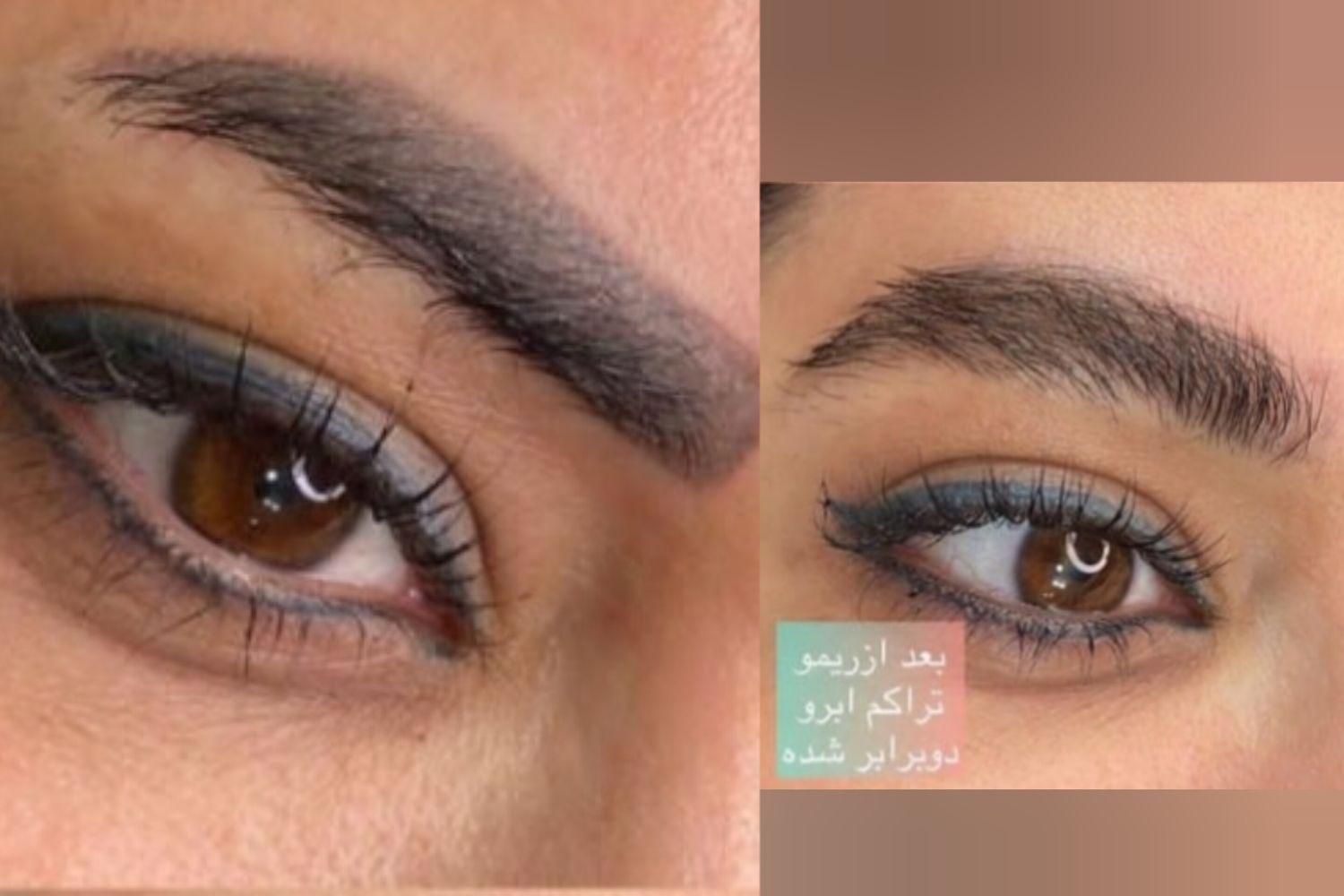 ریموو تخصصی پاک کردن تتو ابرو و خط چشم تضمینی|خدمات آرایشگری و زیبایی|بروجرد, |دیوار