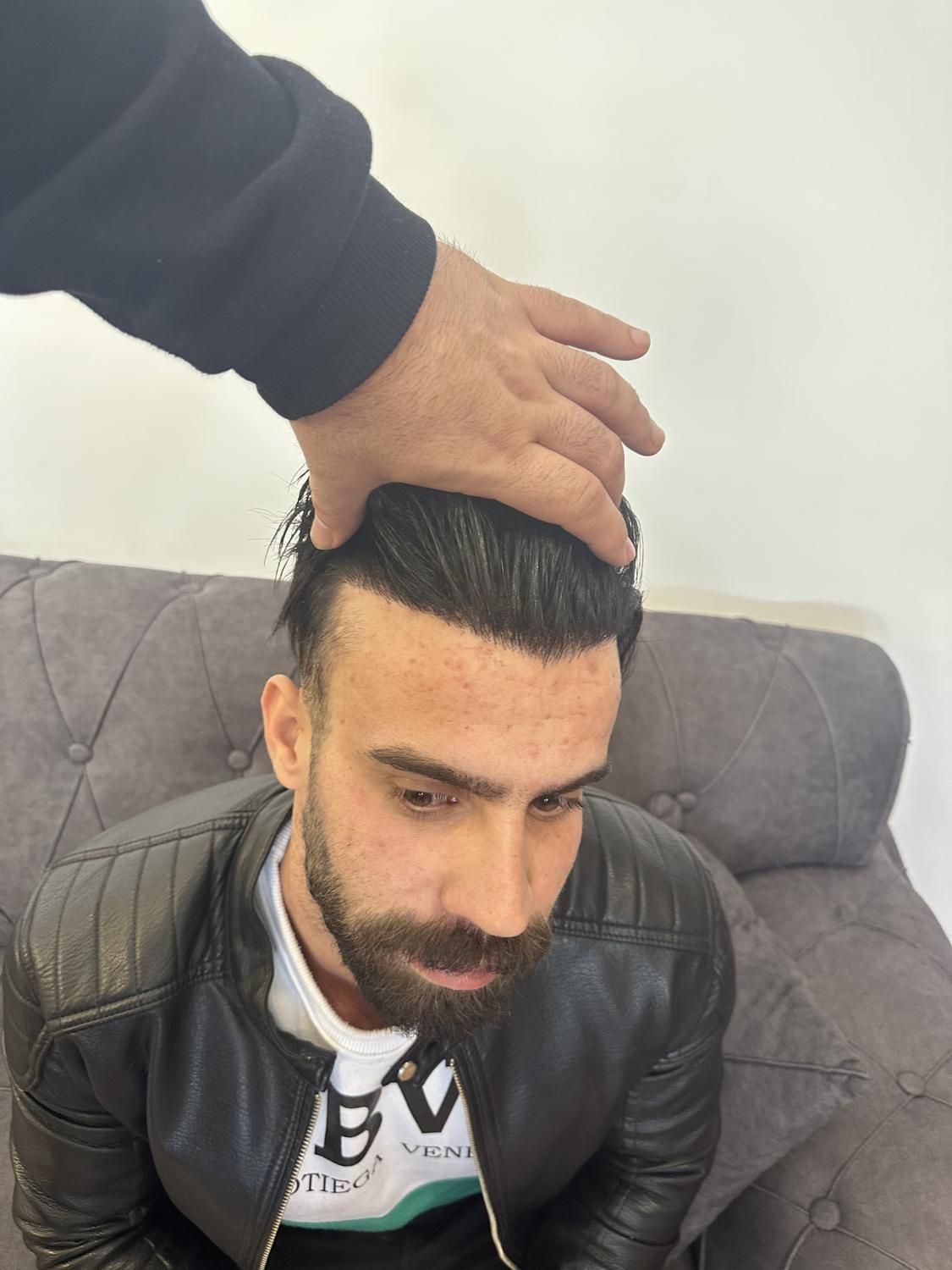 کاشت مو ابرو ریش کلینیک تخصصی اکسیر|خدمات آرایشگری و زیبایی|تبریز, |دیوار