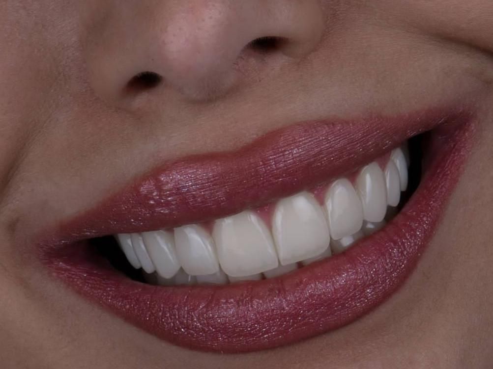 کلینیک دندانپزشکی آرین کوهسنگی|خدمات آرایشگری و زیبایی|مشهد, کوه سنگی|دیوار