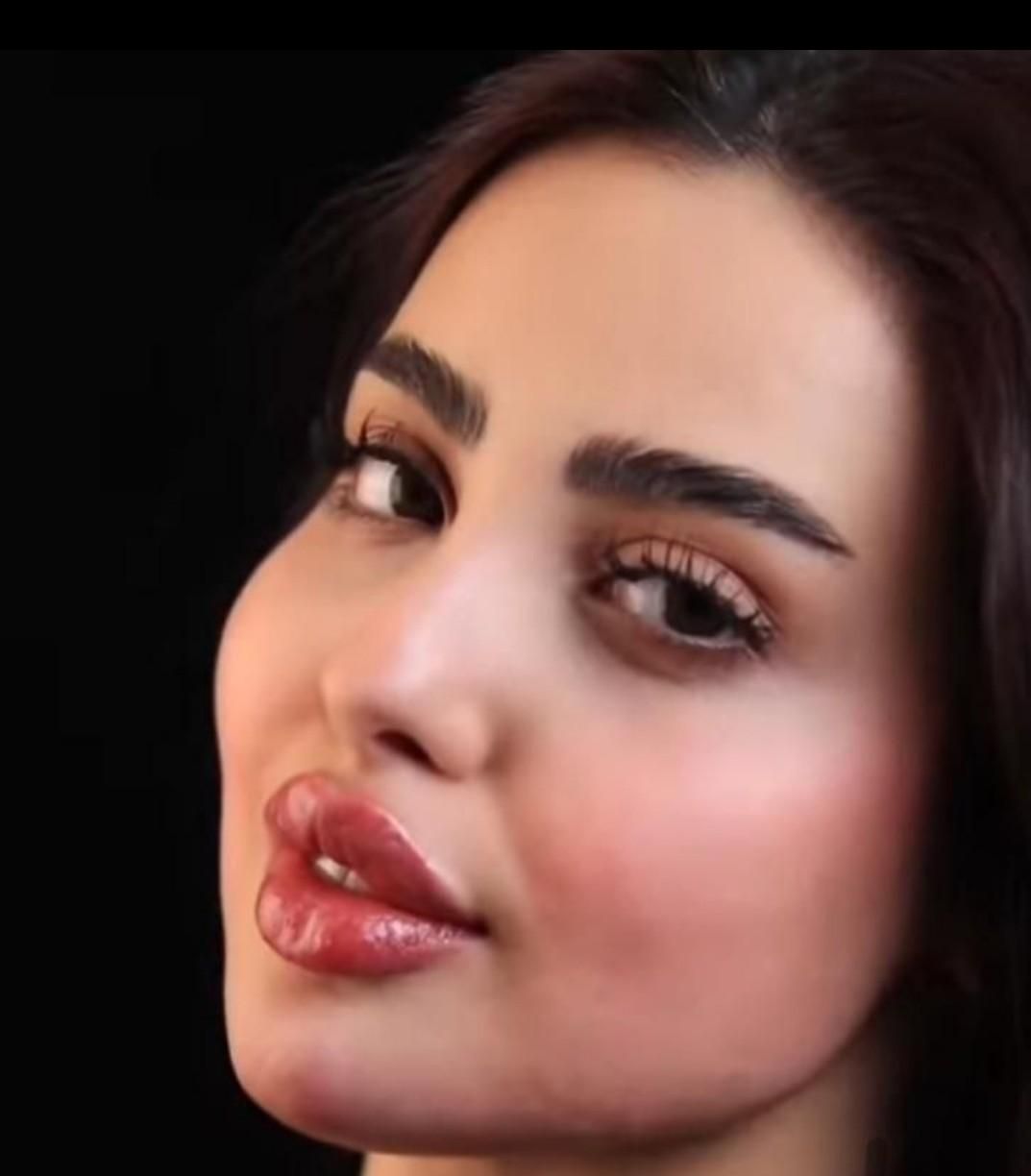 ژل و بوتاکس و لیفت نخ مزوتراپی و آنزیم.فیلربادی|خدمات آرایشگری و زیبایی|کرج, مهرویلا جنوبی|دیوار