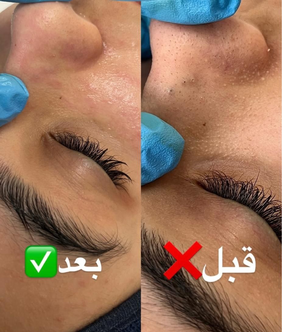 فیشال و خدمات تخصصی پوست توسط پیراپزشک در مطب پزشک|خدمات آرایشگری و زیبایی|مشهد, سجاد شهر|دیوار
