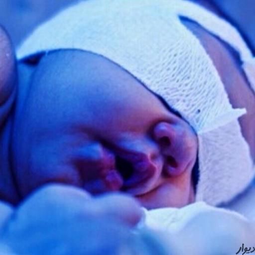 اجاره دستگاه زردی نوزاد فتوتراپی ۲۰۲۳ کل تهران|خدمات آرایشگری و زیبایی|تهران, اتابک|دیوار
