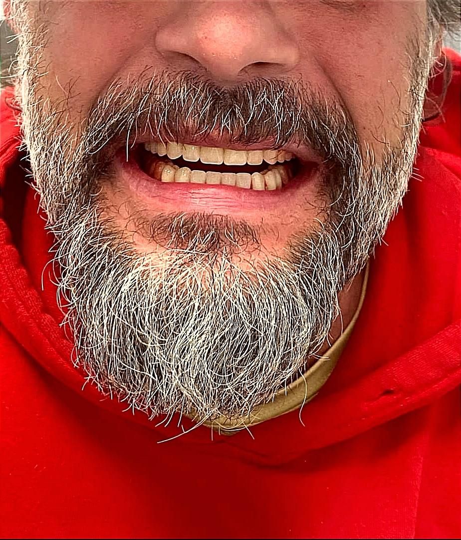 دندان مصنوعی(اقساطی)دندانسازی|خدمات آرایشگری و زیبایی|ارومیه, |دیوار