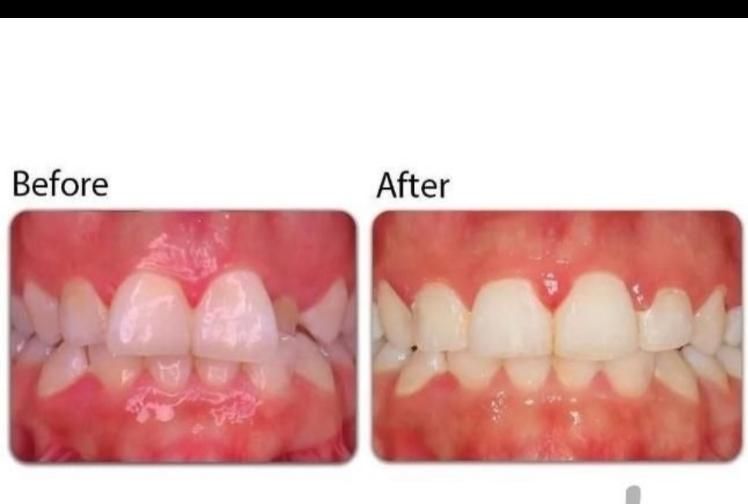 ارتودنسی اقساط بدون پیش پرداخت|خدمات آرایشگری و زیبایی|مشهد, شهرک رازی (شهرک غرب)|دیوار