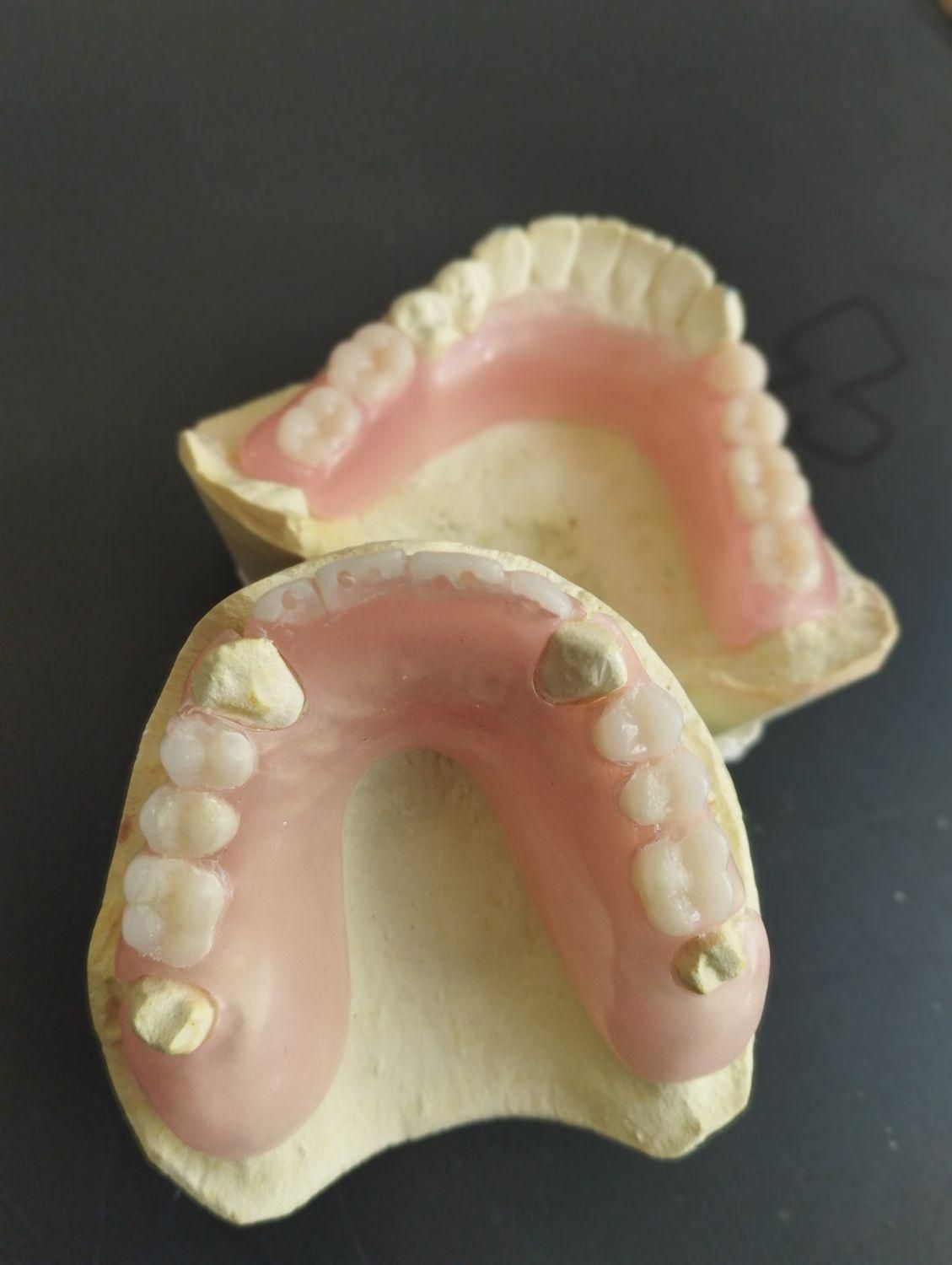 ساخت دست دندان و رفع لقی و شکستگی|خدمات آرایشگری و زیبایی|تهران, سبلان (لشگر)|دیوار