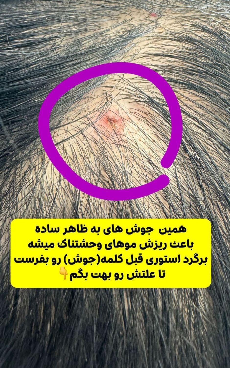 اسکراپ اسکالپ تخصصی (درمان ریزش مو)|خدمات آرایشگری و زیبایی|قم, زنبیل‌آباد (شهید صدوقی)|دیوار