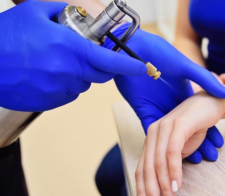 درمان زگیل تناسلی/لیزر/کرایو فریز/hpv/توسط پزشک|خدمات آرایشگری و زیبایی|اهواز, کیانپارس |دیوار