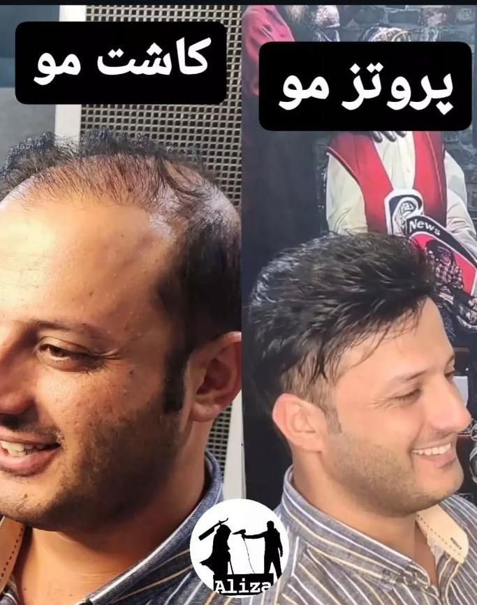 پروتز مو و چسب پروتز مو شیراز|خدمات آرایشگری و زیبایی|شیراز, ملاصدرا|دیوار