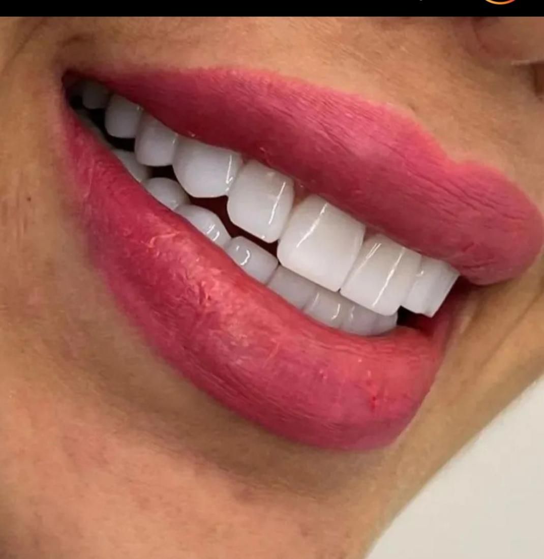 خدمات دندانپزشکی کامپوزیت دندان|خدمات آرایشگری و زیبایی|اسلام‌شهر, باغ فیض|دیوار