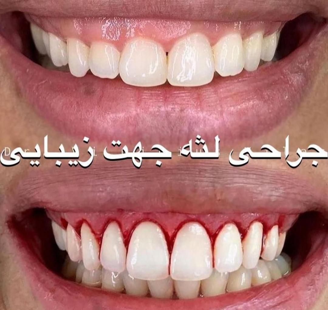 کلینیک زیبایی دندان « کامپوزیت و لمینیت اقساطی|خدمات آرایشگری و زیبایی|قم, باجک دو|دیوار