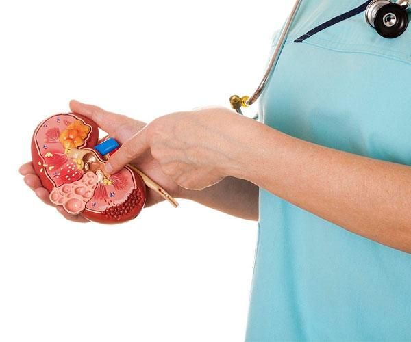 سنگ کلیه|آرایشی، بهداشتی، درمانی|مشهد, شهرک رازی (شهرک غرب)|دیوار